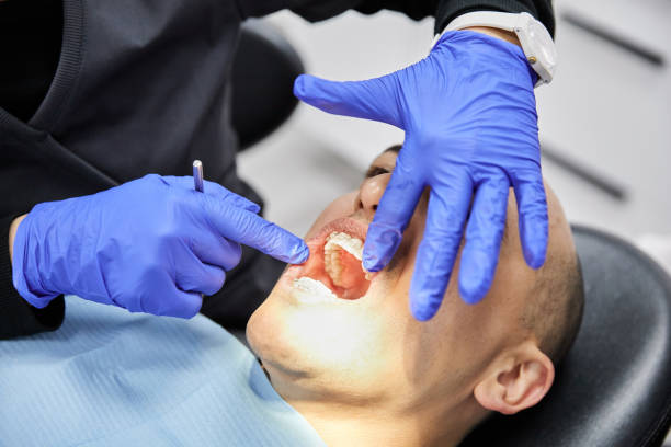 Best Emergency Treatment for Dental Infections or Abscesses in Maunawili, HI