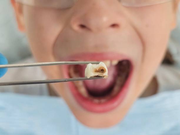 Best Emergency Gum Treatment in Maunawili, HI
